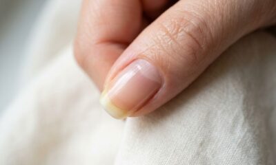 4 sinais por trás das unhas amareladas que muita gente ignora e o que fazer para recuperar a aparência saudável