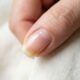 4 sinais por trás das unhas amareladas que muita gente ignora e o que fazer para recuperar a aparência saudável