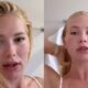 Mulher loira com rosto inchado em duas imagens, em uma ela prende o cabelo