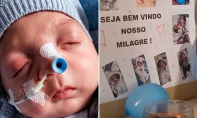 Bebê Noah com sonda no nariz e cartaz "Seja Bem Vindo Nosso Milagre!" com fotos