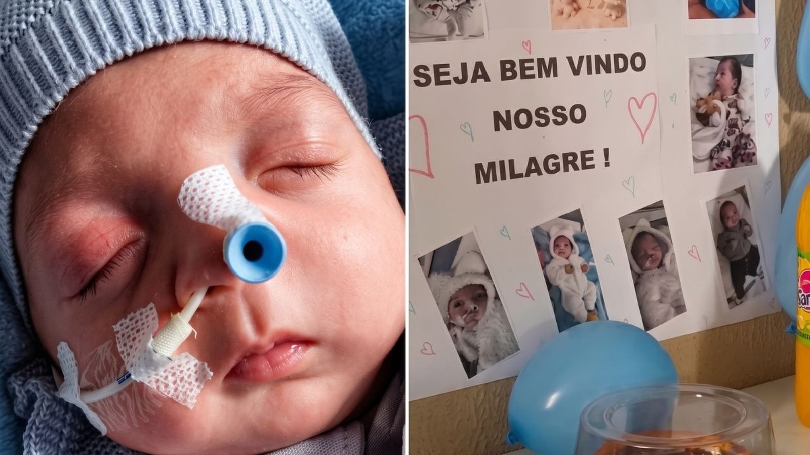 Bebê Noah com sonda no nariz e cartaz "Seja Bem Vindo Nosso Milagre!" com fotos