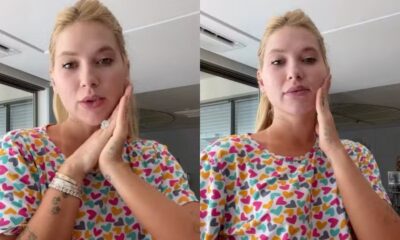 Díptico: Virginia Fonseca, loira, com camiseta colorida de corações, toca o rosto indicando dor