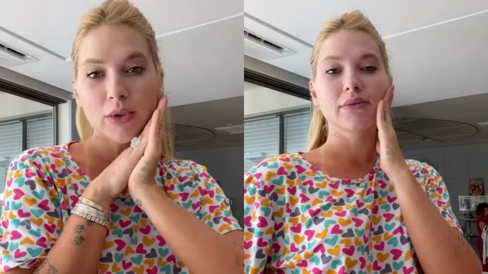 Díptico: Virginia Fonseca, loira, com camiseta colorida de corações, toca o rosto indicando dor