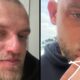 Close-up de homem barbudo com rosto e lábio feridos, apontando para o corte na boca