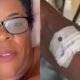 Rosto de mulher de óculos e braço com acesso intravenoso e adesivo médico