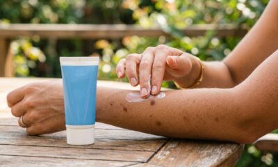 Nem sempre é apenas uma cicatriz: a mancha escura que aparece depois de uma picada de mosquito tem uma explicação e pode levar meses para desaparecer