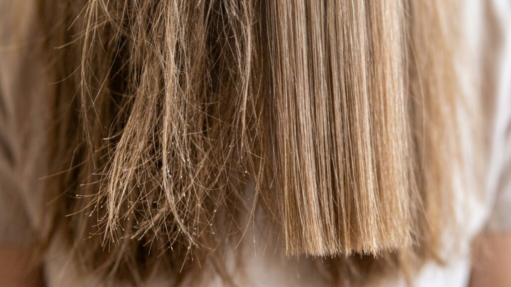 Adeus, cabelo fraco e fino: cuidados simples no dia a dia podem ajudar a deixar os fios mais resistentes, encorpados e menos quebradiços