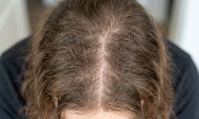 Segundo a psicologia, a queda de cabelo não significa falta de cuidado, mas pode reforçar a necessidade de reduzir o estresse e cuidar da autoestima