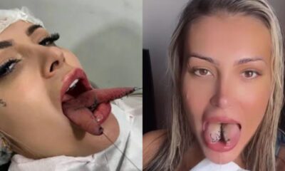 Riscos da bifurcação na língua e os alertas de Andressa Urach após arrependimento