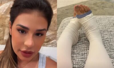 Simone Mendes faz cirurgia plástica após emagrecimento e celebra: ‘Meu sonho’