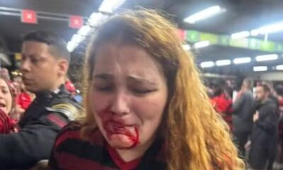 Mulher jovem chora com boca ensanguentada, enquanto homem uniformizado a observa em estação