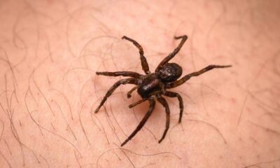 Uma aranha marrom escura em close-up sobre pele humana com pelos finos