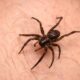 Uma aranha marrom escura em close-up sobre pele humana com pelos finos