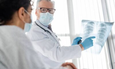 Médico de máscara e luvas aponta radiografia de tórax para paciente