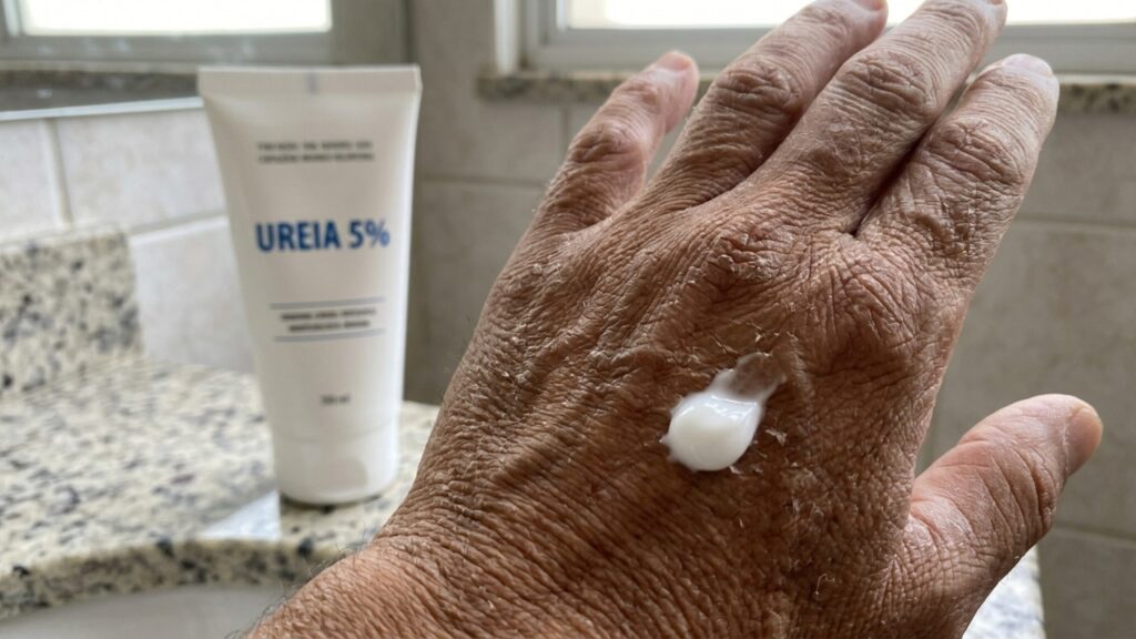 Dermatologistas explicam: “Se suas mãos ficam ressecadas e com pequenas fissuras, cremes com ureia podem ajudar a reter água na pele e favorecer a recuperação da barreira cutânea”