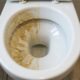 Nem vinagre nem bicarbonato: esse ingrediente ajuda a dissolver a mancha escura que acumula no fundo do vaso sanitário e pode facilitar a limpeza