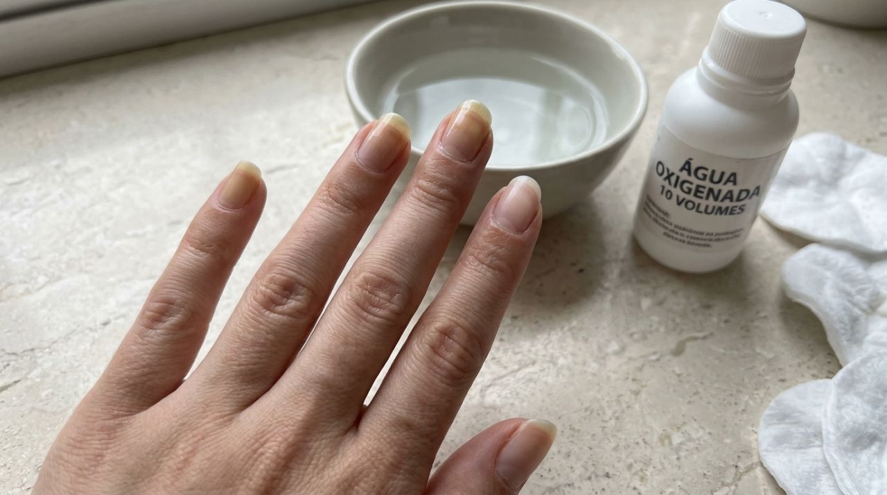 Deixar as unhas de molho em água morna com água oxigenada 10 volumes: para que serve a mistura e por que 10 minutos podem ajudar a clarear as unhas amareladas pelo esmalte