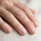 Dermatologistas explicam: se as unhas apresentam pequenas linhas verticais depois dos 60, pode não ser necessariamente falta de vitaminas, mas uma mudança natural com a idade, embora alterações repentinas mereçam avaliação