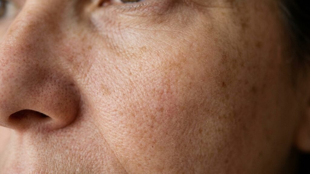 Dermatologistas afirmam: “Depois dos 50 anos, usar um hidratante facial com niacinamida pode ajudar a uniformizar o tom da pele e reduzir a aparência dos poros, mas os resultados não aparecem da noite para o dia”