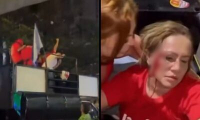 Mulher ferida com marcas vermelhas no rosto e pessoas em caminhão de som