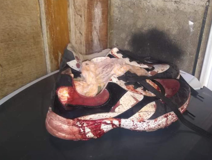 Tênis manchado de sangue