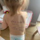 Criança com informações familiares escritas na pele