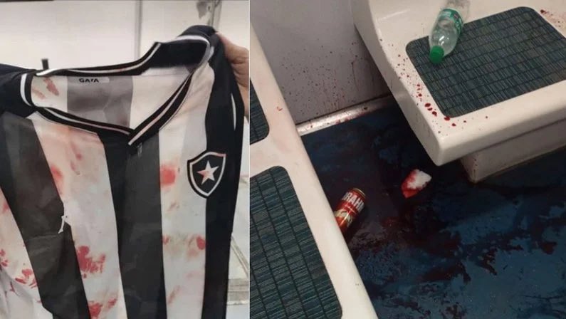 Torcedores do Botafogo relatam ataque de organizadas do Flamengo nos trens e pessoas feridas após jogo com Fortaleza