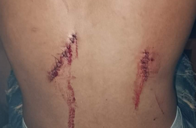 Ferimentos Jacarezinho