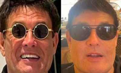 Sérgio Mallandro antes e depois da harmonização facial