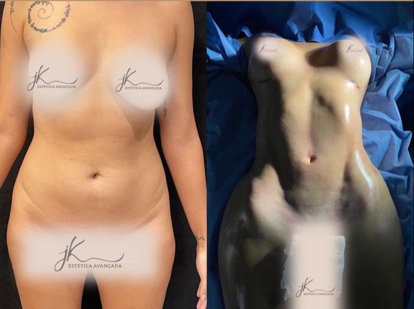 Sarah Andrade passa por procedimentos estéticos em São Paulo