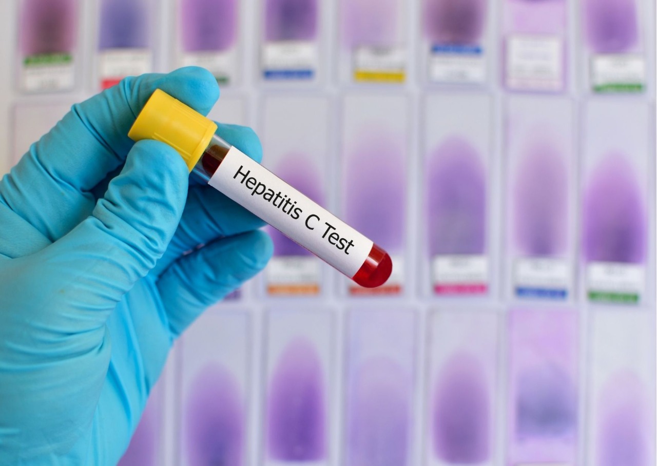 Julho Amarelo- Mês de combate às hepatites virais (Divulgação)
