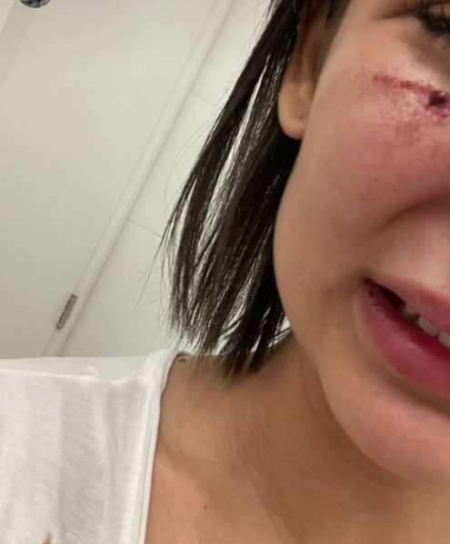 Na imagem, modelo Anna figueiredo