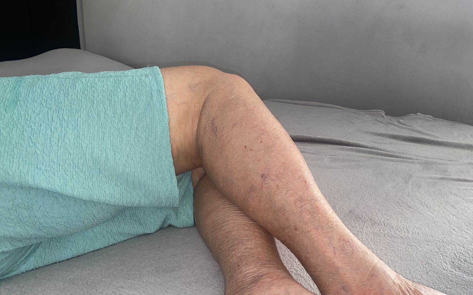 Problemas vasculares