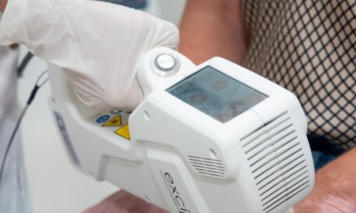 Meu filho tem vitiligo, e agora?