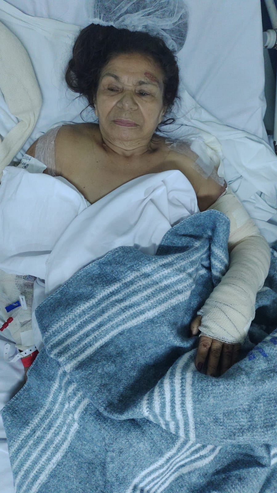 Idosa Eci Coutinho Bella, de 72 anos, é arrastada durante assalto na Pavuna 