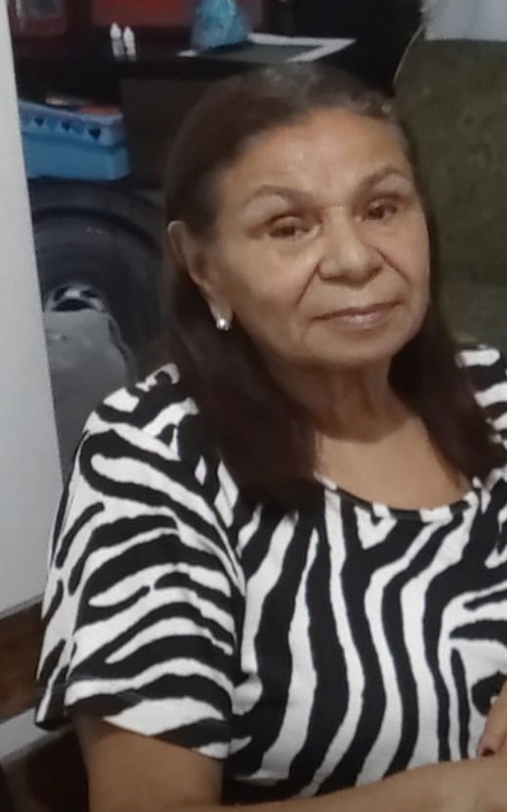 Idosa arrastada por criminosos durante assalto na Pavuna deve passar por cirurgia nesta terça