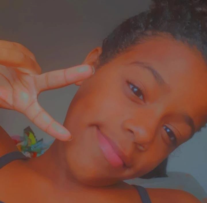 Criança que teve a perna amputada