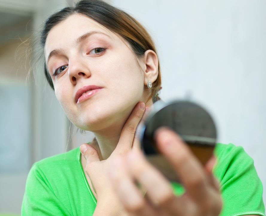 Manchas brancas na pele? Você pode estar sofrendo com fungos