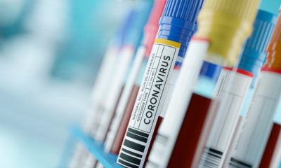 Exames para Covid-19