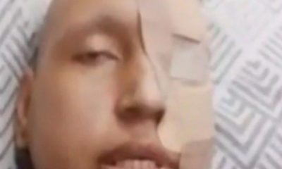 mulher finge ter câncer