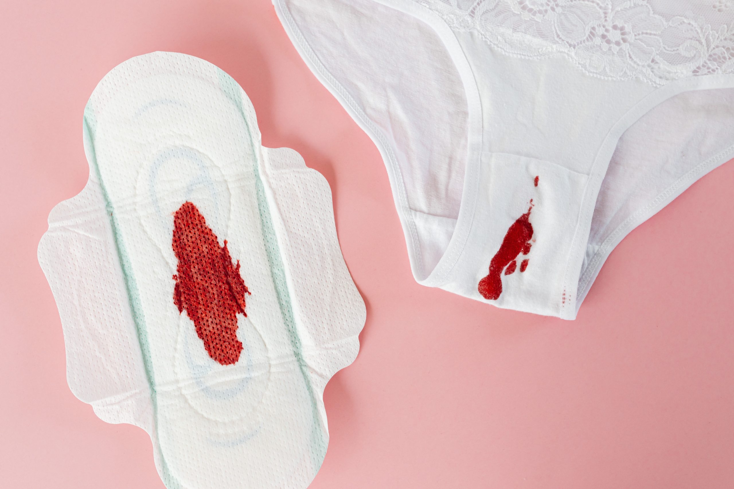 menstruação