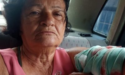 Carmelita Francisca, de 71 anos, foi baleada no braço esquerdo em São Gonçalo