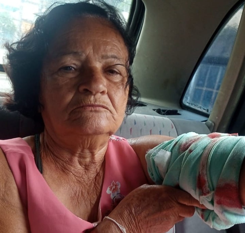 Carmelita Francisca, de 71 anos, foi baleada no braço esquerdo em São Gonçalo